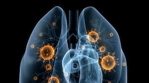 Estudio descriptivo de biopsia pulmonar a cielo abierto en niños
