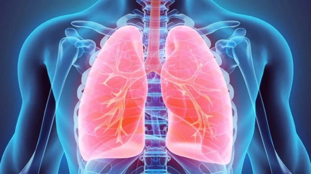 Enfermeedad pulmonar obstructiva crónica