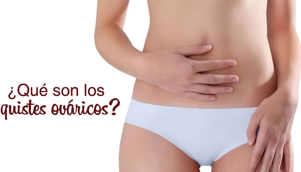 Quistes Ováricos Funcionales