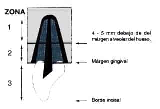 Raíces y los dientes temporales