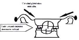 Morfología de la cavidad glenóidea