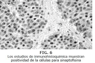 Los estudios de inmunohistoquímica Los estudios de inmunohistoquímica