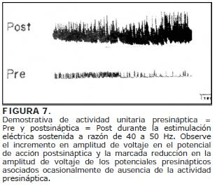 Demostración de actividad unitaria presináptica síndrome Lambert-Eaton Demostración de actividad unitaria presináptica síndrome Lambert-Eaton