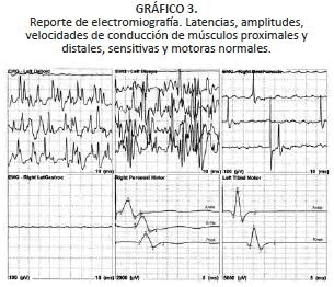 Reporte de electromiografía. Latencias, amplitudes Reporte de electromiografía. Latencias, amplitudes