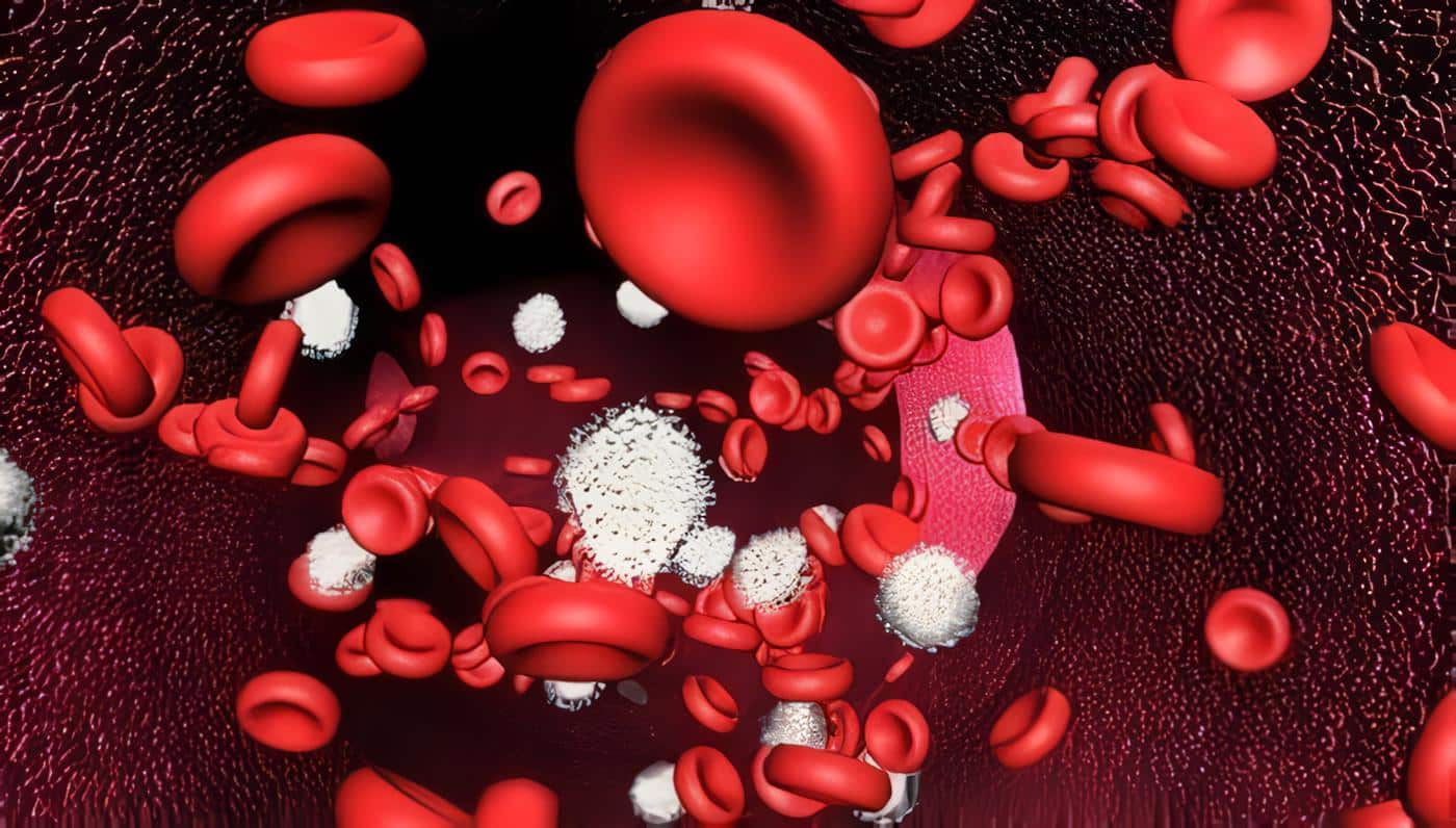 Anemia Megaloblástica y Manifestaciones Neuropsiquiátricas