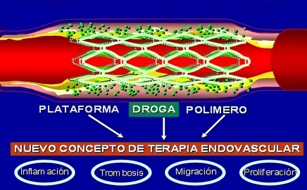 Endoprótesis Liberadoras de Fármacos