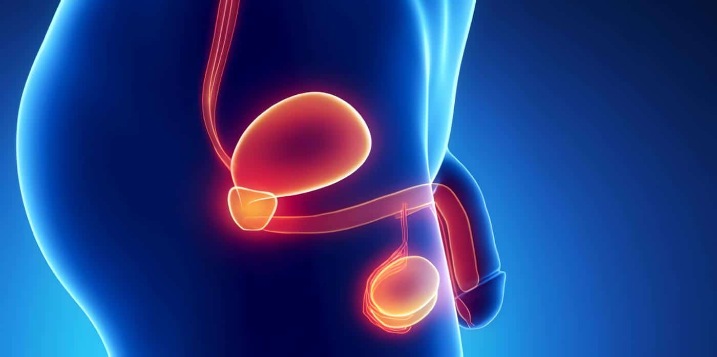 Tumor de Próstata