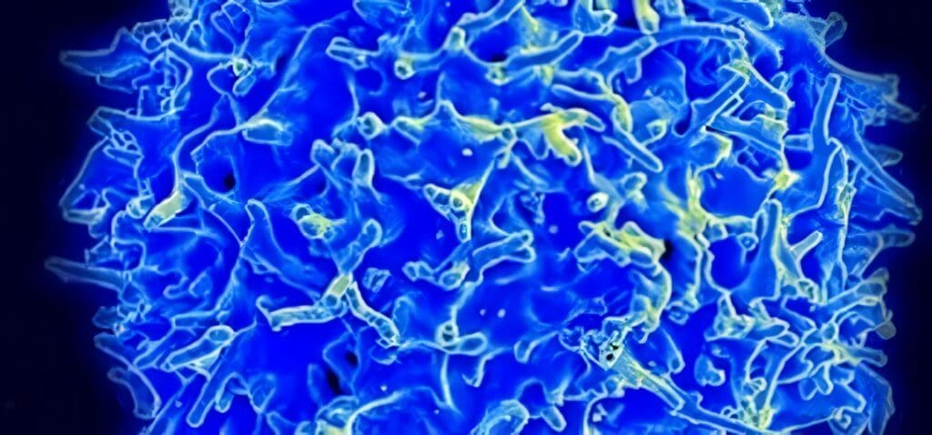 Variante Genética y Cáncer de Pulmón