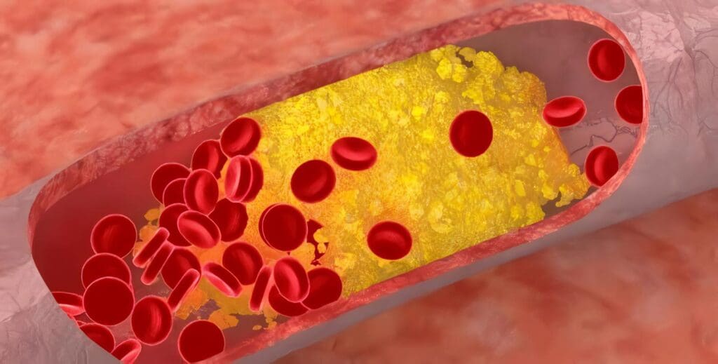 Azúcares en el Hígado puede limpiar Grasas de la Sangre