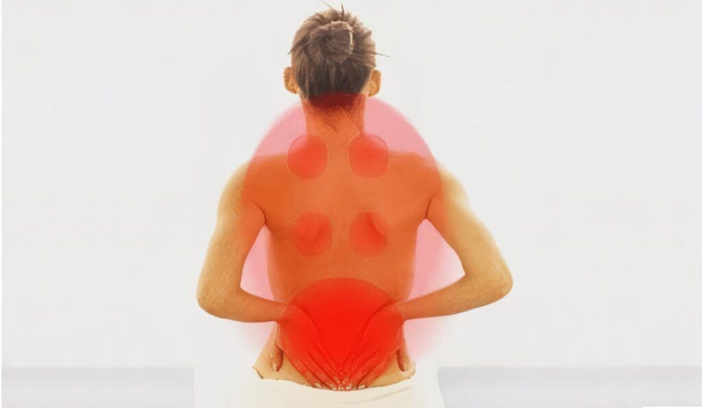 La Fibromialgia Genera un Dolor Real