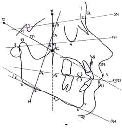 Localización de puntos, planos y vectores