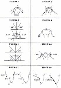 Cortes sagitales de los modelos dentales