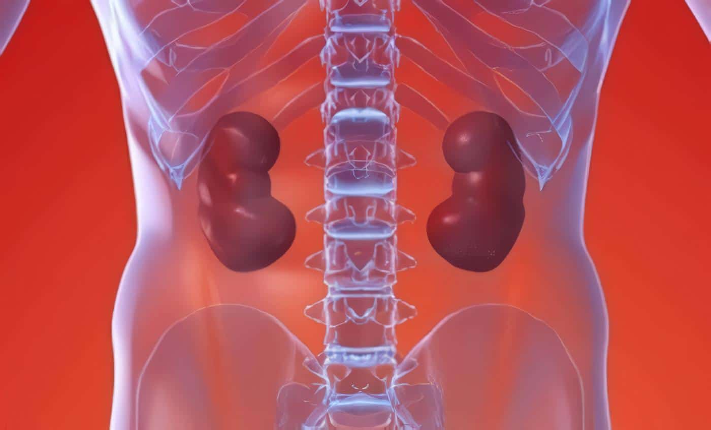 Personas con un Transplante Renal fallece por Cardiopatías o Cáncer