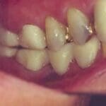 Rehabilitacion-oral-con-enfasis-en-estetica-caso1