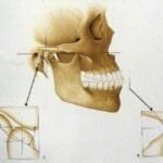 Rehabilitacion-oral-con-enfasis-en-estetica-caso4