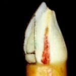 Rehabilitacion-oral-con-enfasis-en-estetica-caso6