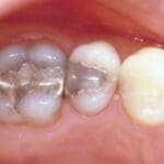 Rehabilitacion-oral-con-enfasis-en-estetica-caso7