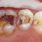 Rehabilitacion-oral-con-enfasis-en-estetica-caso8