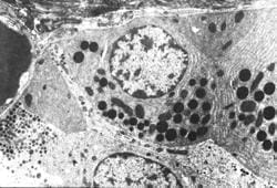 Suplemento25Hipoglicemia