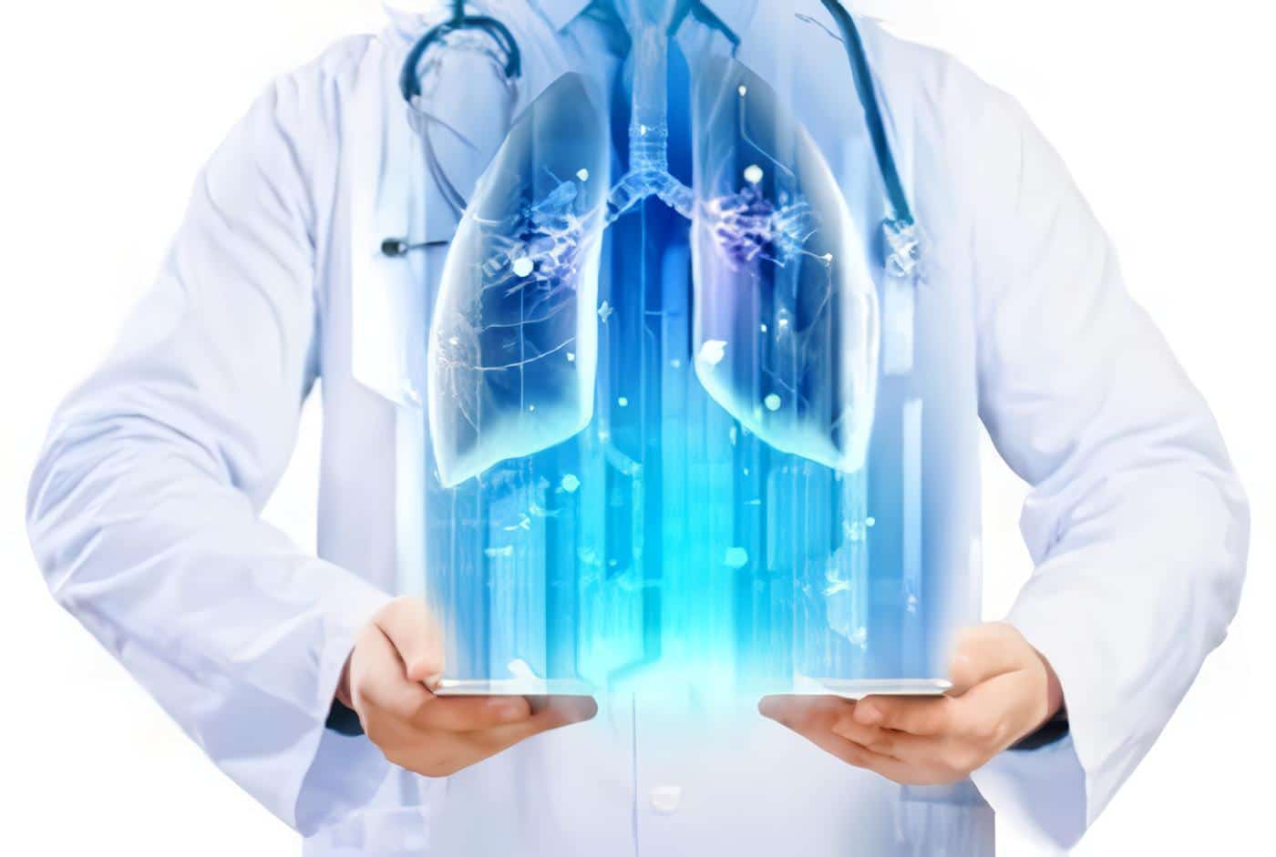 Tratamiento Cáncer de Pulmón
