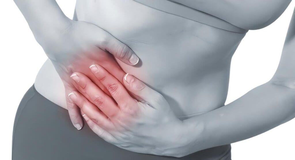 Apendicitis Aguda