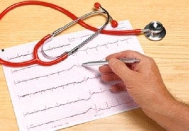 Detectan ADN relacionados con Arritmias Peligrosas