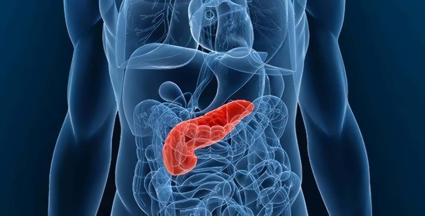 Cáncer de Páncreas