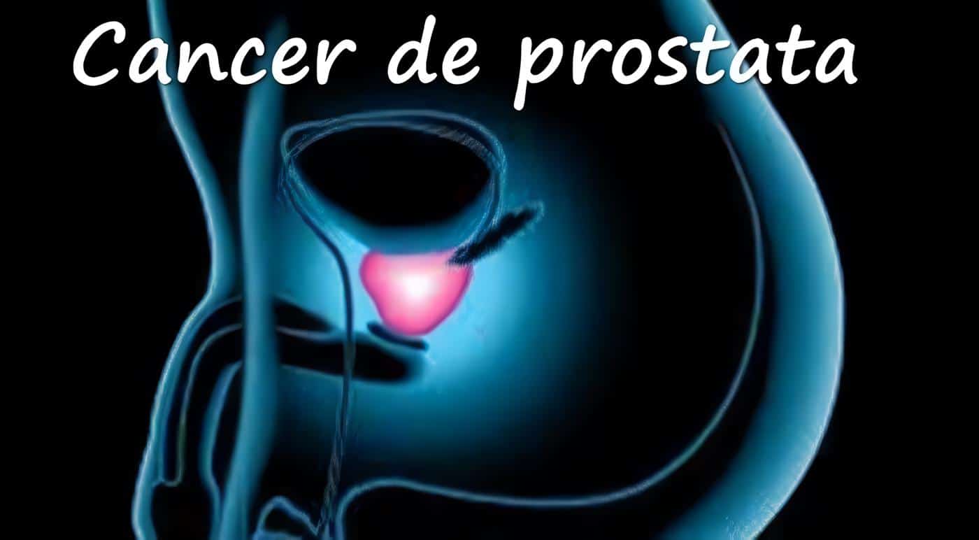 Cáncer de Próstata
