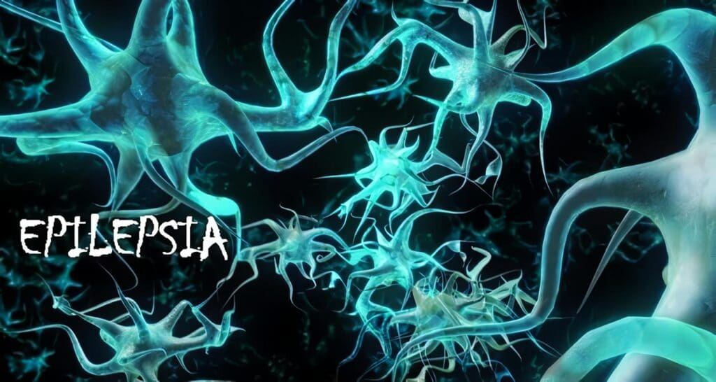Pregabalina Estudio de Bioequivalencia, Epilepsia