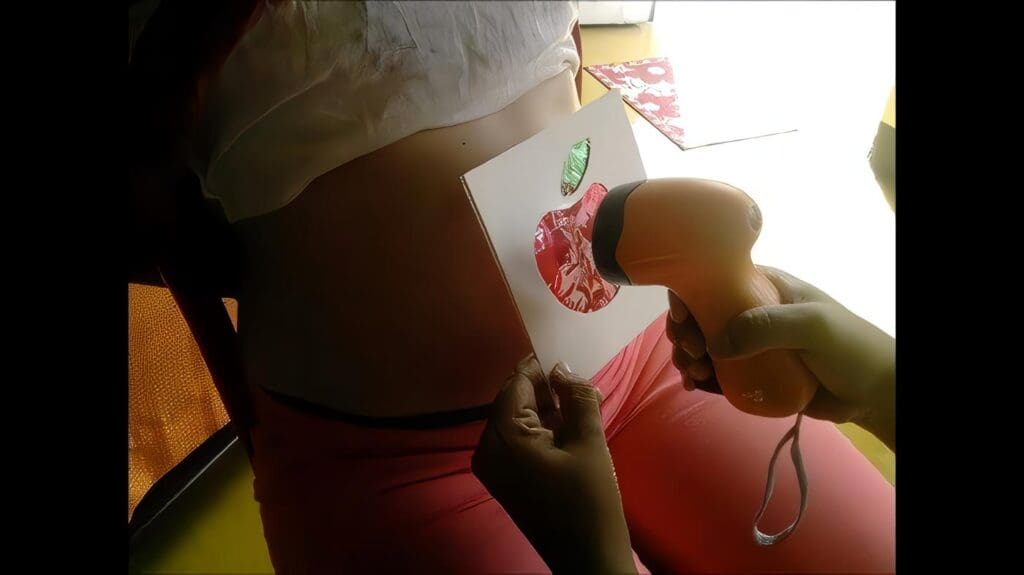 Estimulación Uterina
