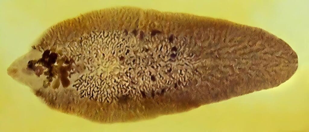 Fasciolosis Hepática
