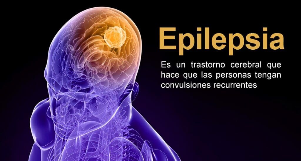 Libro sobre Epilepsia