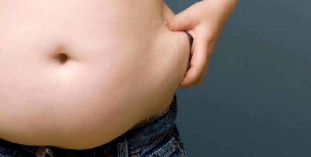 Obesidad y el Dolor Crónico