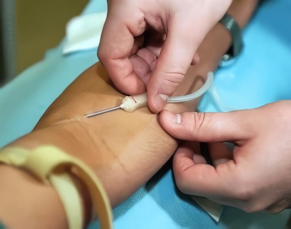 Prueba Sanguínea Podría Predecir el Ataque Cardíaco