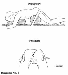 técnicas posición e insición Técnicas posición e insición