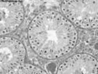 tensiometro-suplediezynueve-2