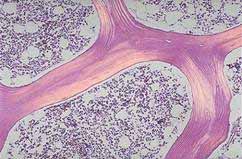 Anatomía e histología del Hueso