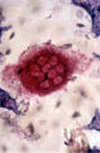 Tipos de células óseas - osteoblastos