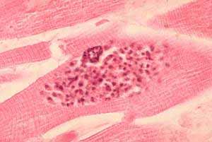tensiometro-suplementocuatro-fig2