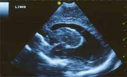 tensiometro-suplementocuatro-fig5