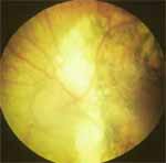 tensiometro-suplementocuatro-fig7