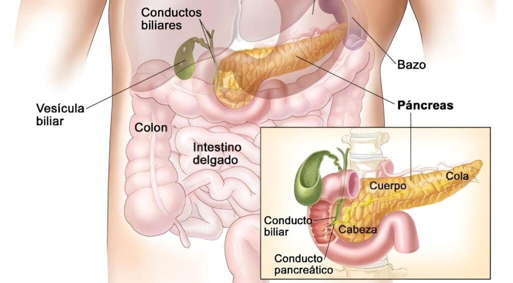 Tumores Neuroendocrinos Pancreáticos