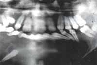 Estructuras Dentarias – Quistes Ontogénicos Estructuras Dentarias – Quistes Ontogénicos