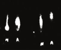 Activación molecular - contraste forzado hasta el blanco y negro.