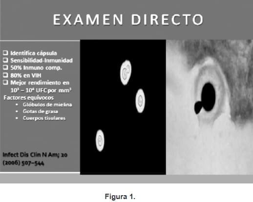 Examen de Tinta China en Antígeno Criptococósico