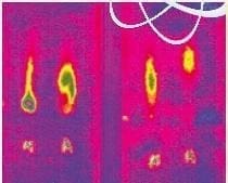 Activación molecular - Electroforesis del Extracto de Alfalfa