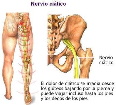 Nervio ciático Nervio ciático
