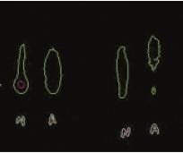 Activación molecular - representación en curvas de nivel