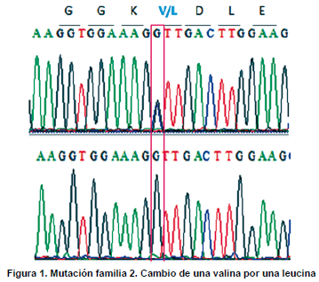 Mutación familia, cambio de una valina por una leucina