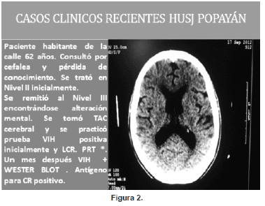 Casos clínicos de Husj